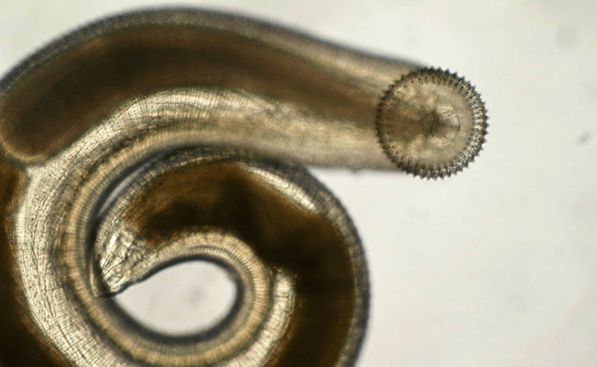 gnathostome parasitaire sous-cutané